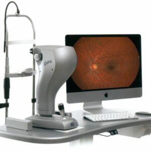 Retinógrafo Cobra HD - Imagen 2