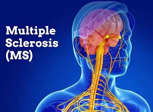 fotografía en color de cartel de la esclerosis multiple