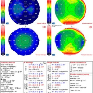 Topógrafo Corneal Oem Sirius para Gabinete Oftalmológico - Imagen 2