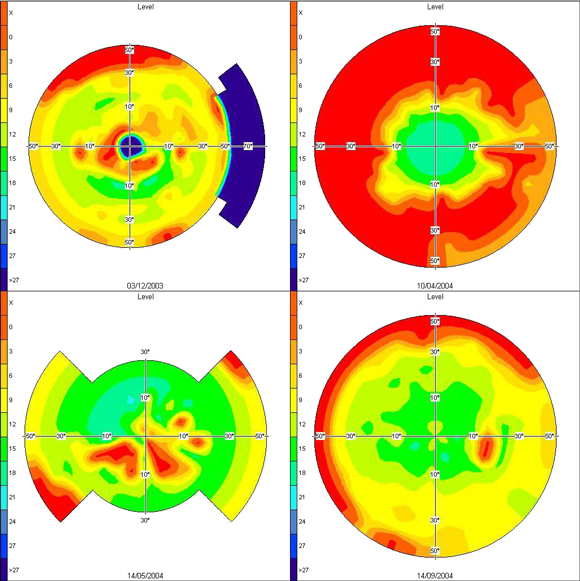 Analizador de Campo Visual AP-300 - Imagen 3
